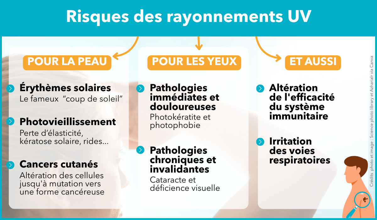 Risques rayons ultraviolets - AISMT13 Risques des rayons ultraviolets pour la santé des travailleurs